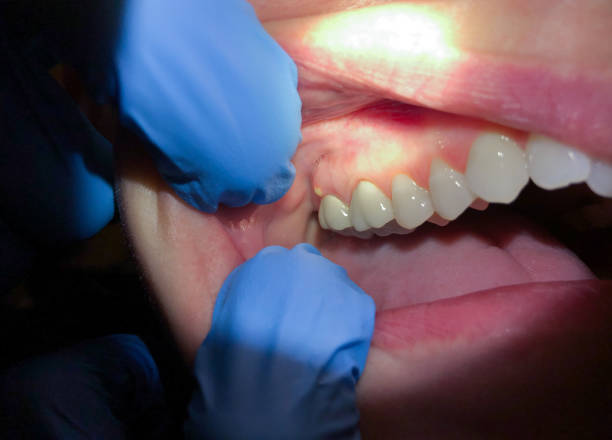 Best Orthodontic Emergency Dentist in Wilkes Barre, PA
